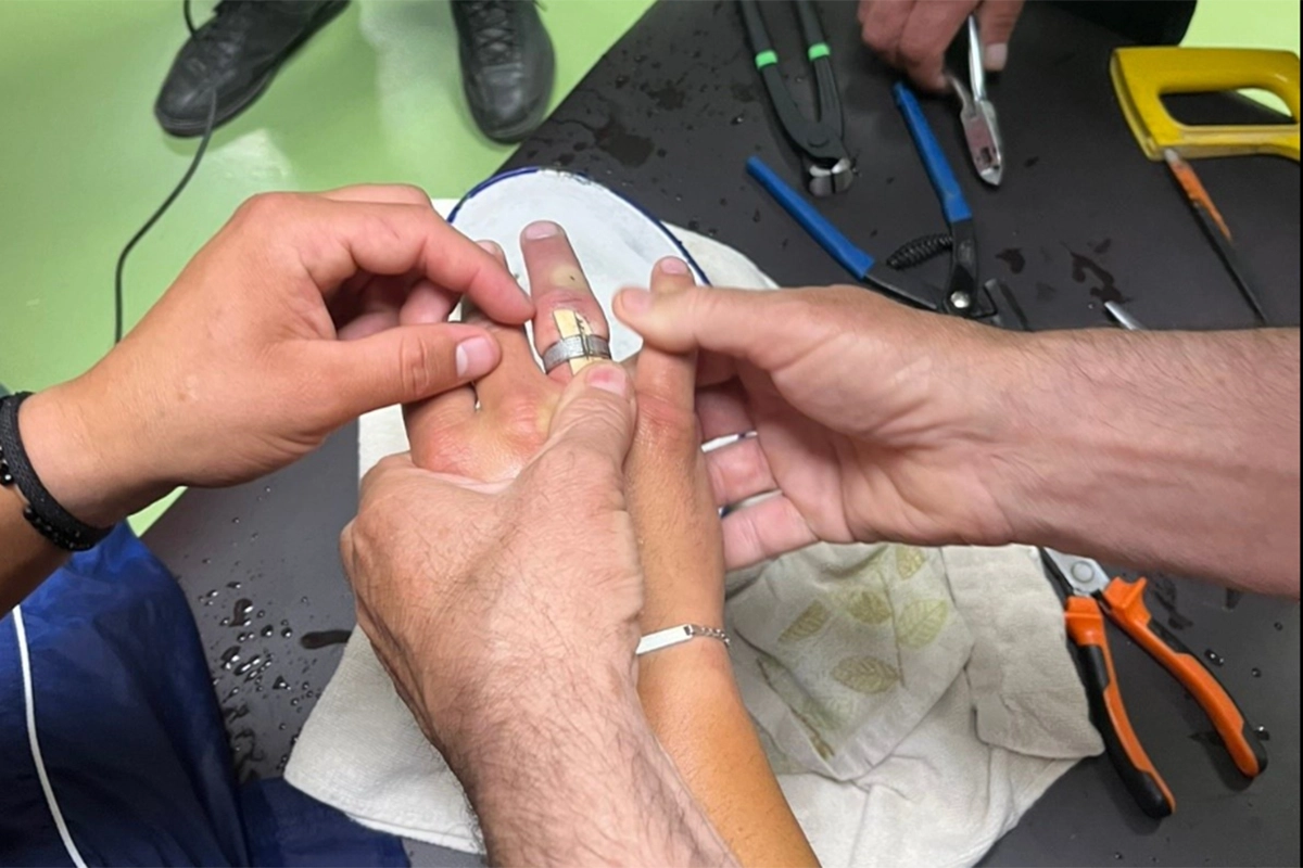 Neobična intervencija: Vatrogasci u Prijedoru skidali prsten s ruke (FOTO)