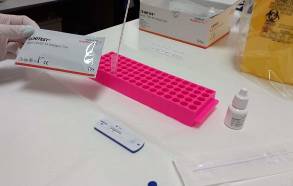 U Institutu u Banjaluci počelo testiranje brzim antigenskim testovima