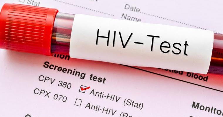 Srpska bilježi nagli skok broja zaraženih HIV-om