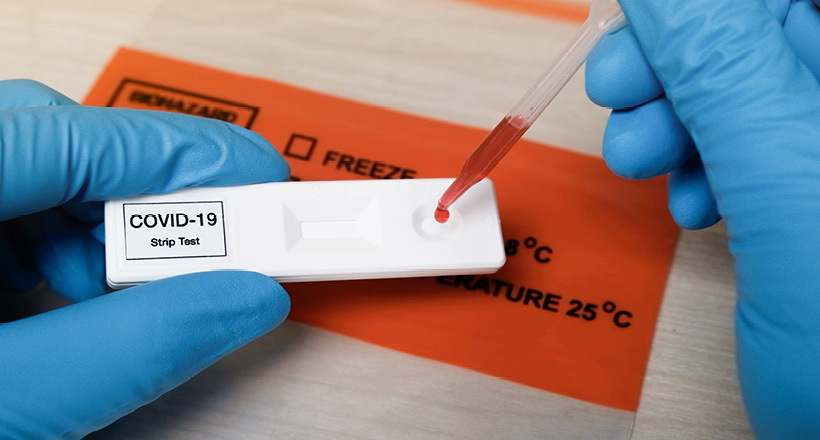 U Srpskoj 55 novozaraženih, 14 osoba preminulo