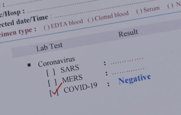 Srpska nakon 11 mjeseci bez novozaraženih, četiri osobe preminule
